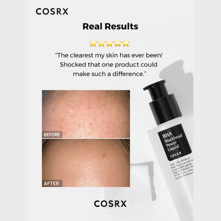 COSRX BHA Blackhead Power Liquid- Lillys Pharmacy and Health Store