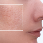 Enlarged Pores - Lillys Pharmacy and Health Store