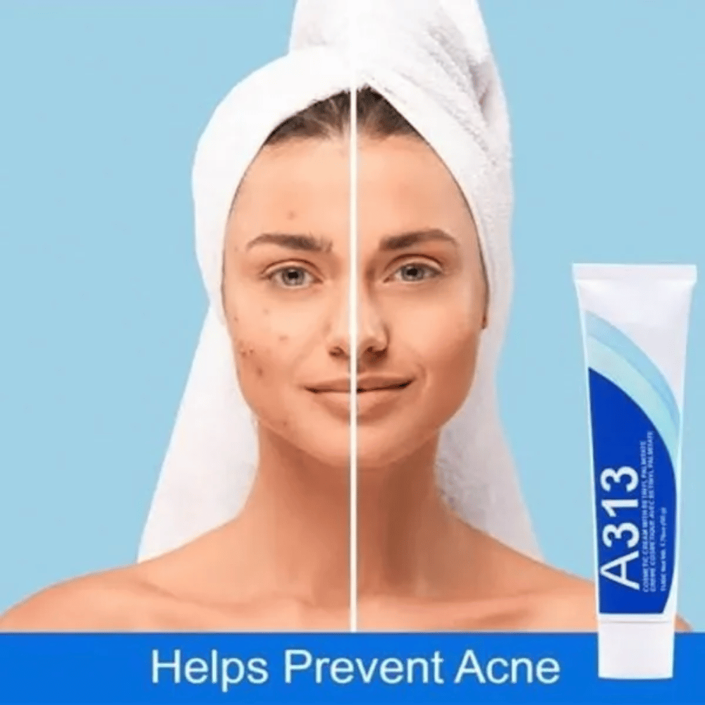 A313 Retinol Cream 50g- Lillys Pharmacy and Health Store