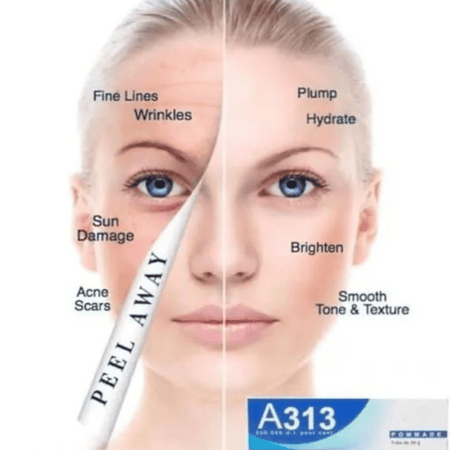 A313 Retinol Cream 50g- Lillys Pharmacy and Health Store