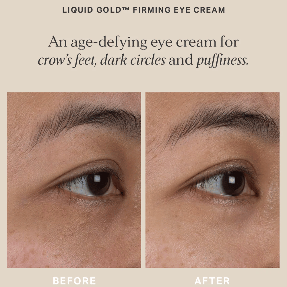 Alpha-H Liquid Gold Firming Eye Cream 15ml- Lillys Pharmacy and Health Store