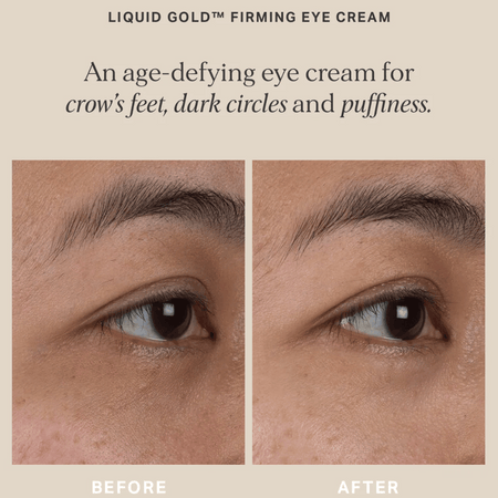Alpha-H Liquid Gold Firming Eye Cream 15ml- Lillys Pharmacy and Health Store