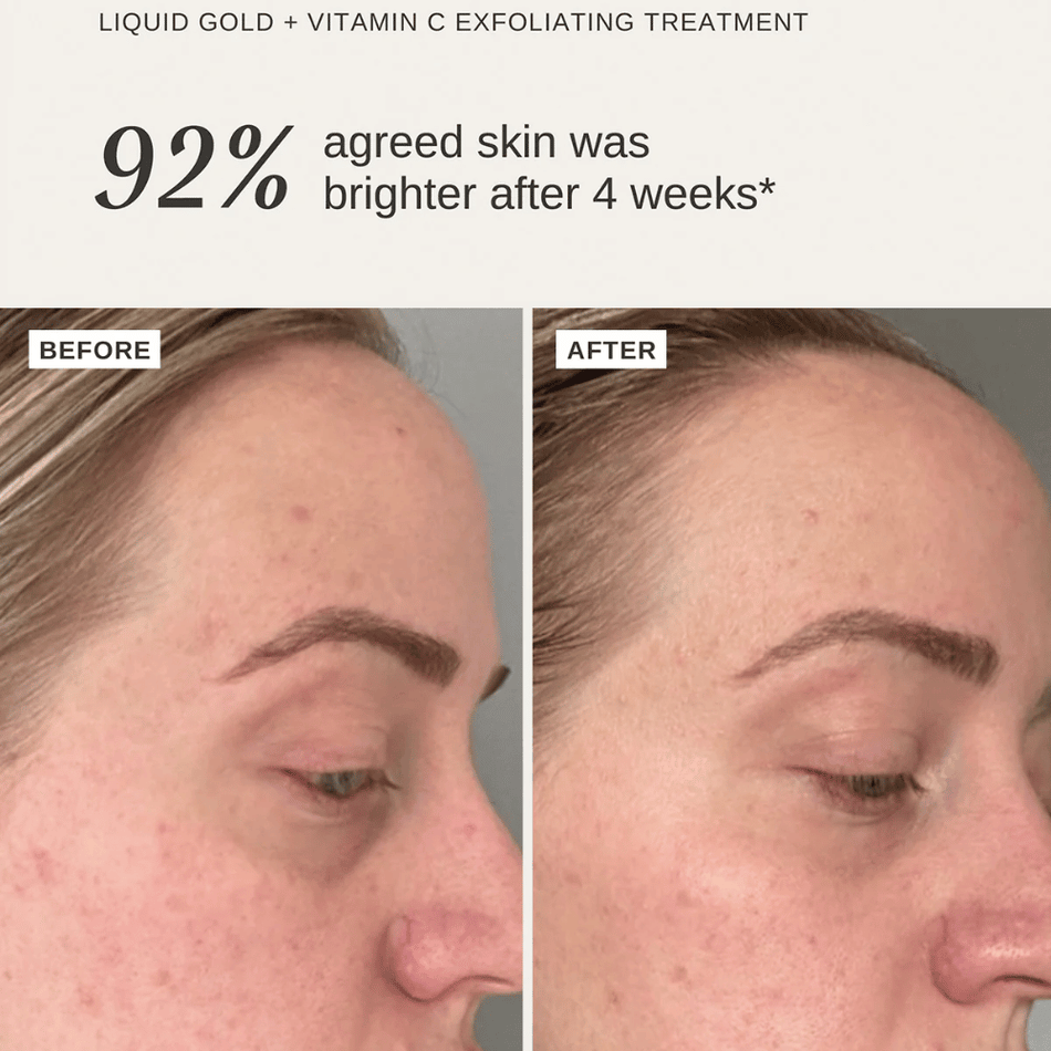 Alpha-H Liquid Gold + Vitamin C Trial Kit- Lillys Pharmacy and Health Store