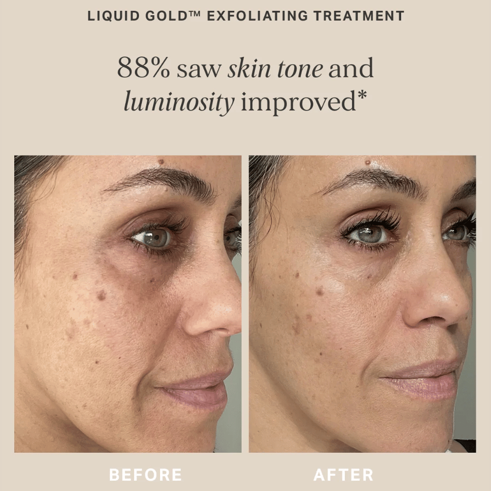 Alpha-H Liquid Gold with 5% Glycolic Acid 200ml- Lillys Pharmacy and Health Store