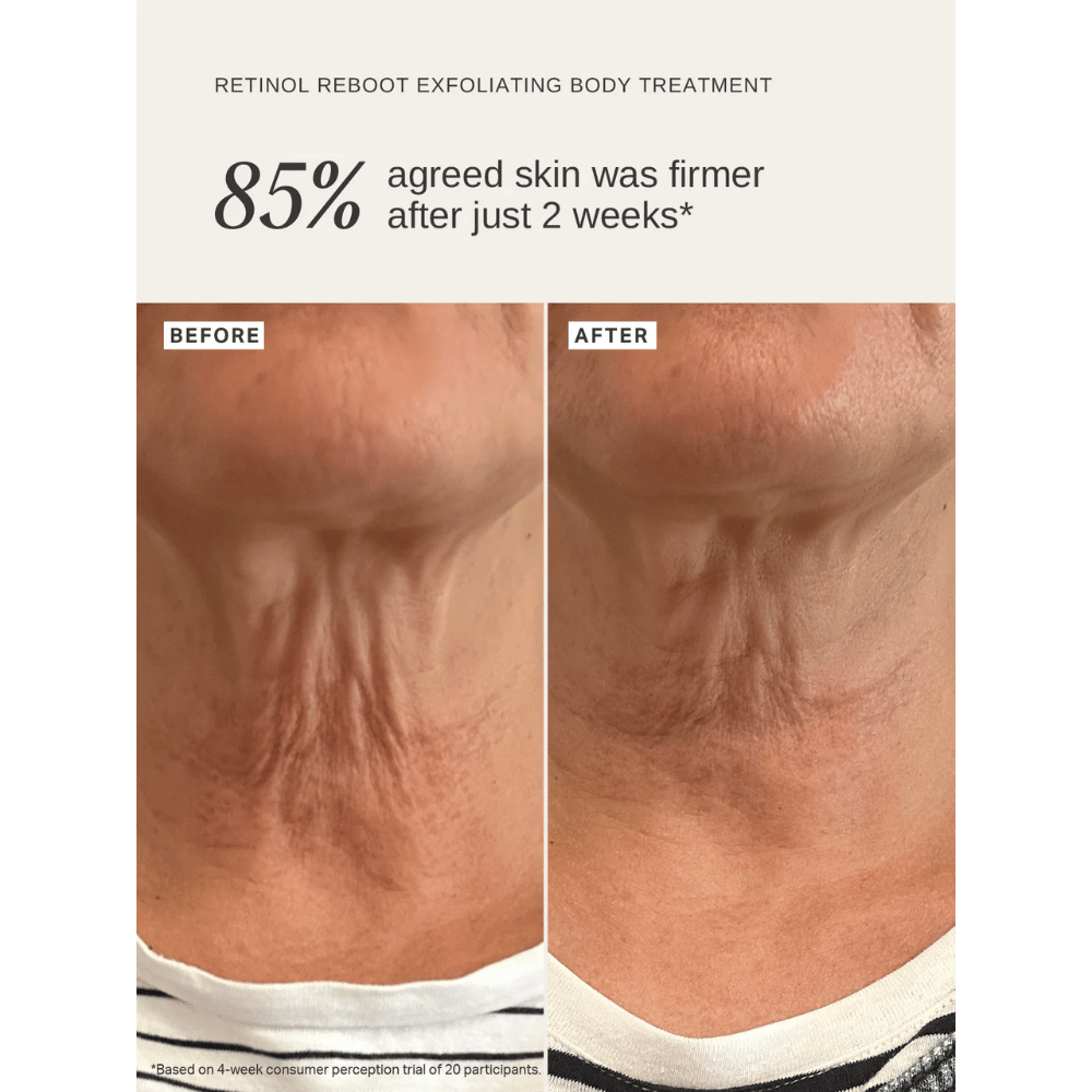 Alpha-H Retinol Reboot Exfoliating Body Treatment 120ml- Lillys Pharmacy and Health Store