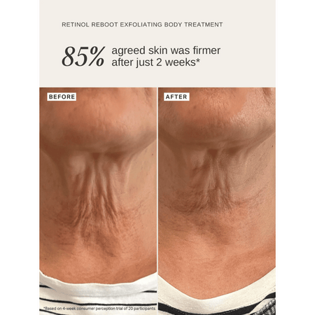Alpha-H Retinol Reboot Exfoliating Body Treatment 120ml- Lillys Pharmacy and Health Store