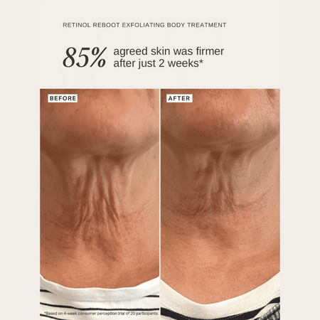 Alpha-H Retinol Reboot Exfoliating Body Treatment 120ml- Lillys Pharmacy and Health Store