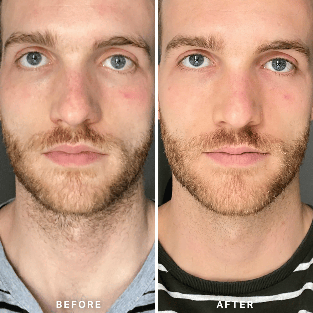 Alpha-H Vitamin B Serum with 5% Niacinamide 10ml- Lillys Pharmacy and Health Store