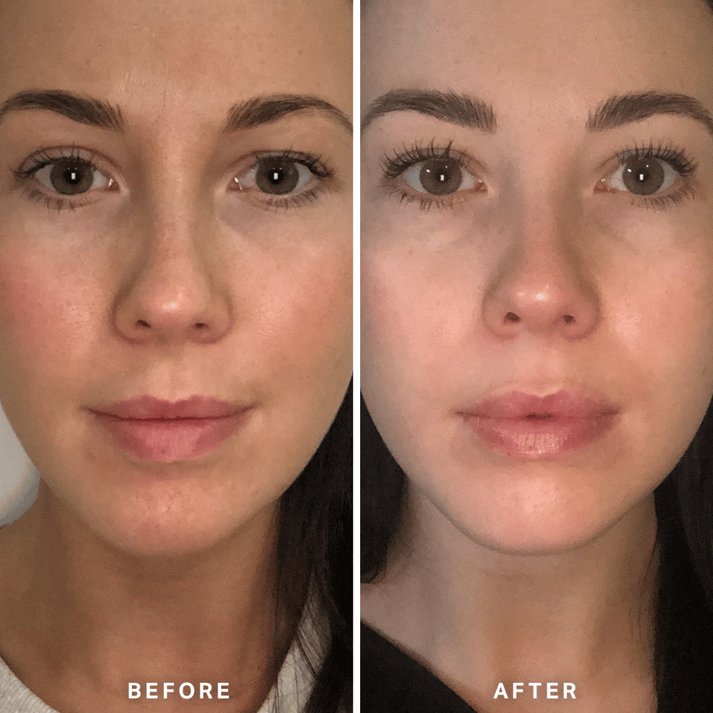 Alpha-H Vitamin B Serum with 5% Niacinamide 10ml- Lillys Pharmacy and Health Store