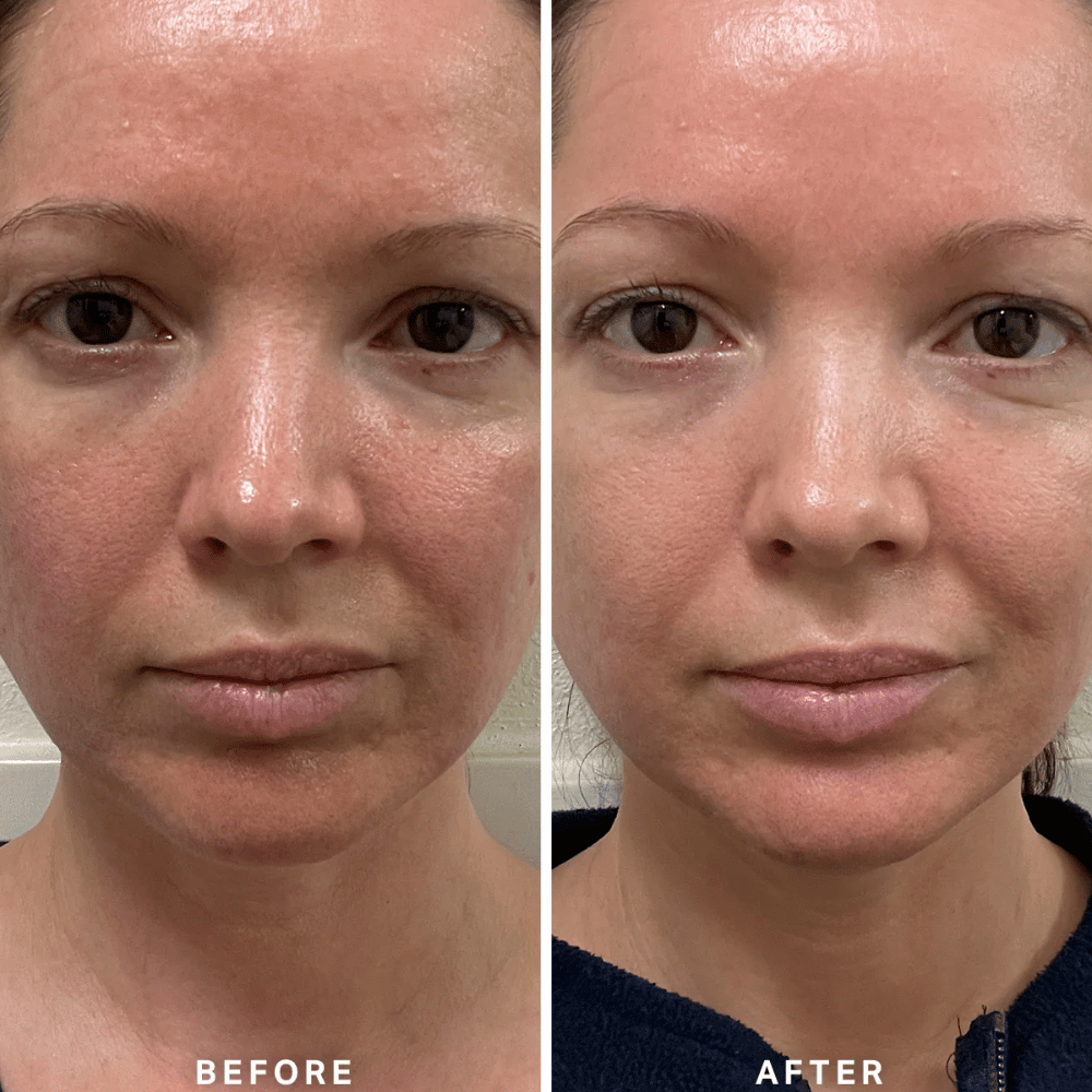 Alpha-H Vitamin B Serum with 5% Niacinamide 10ml- Lillys Pharmacy and Health Store