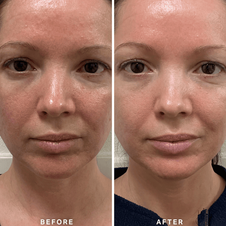 Alpha-H Vitamin B Serum with 5% Niacinamide 10ml- Lillys Pharmacy and Health Store