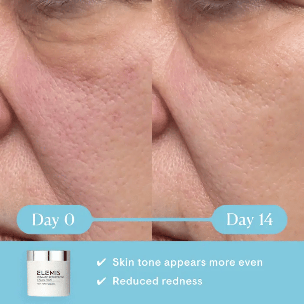 Elemis Dynamic Resurfacing Facial Pads- Lillys Pharmacy and Health Store