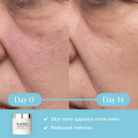 Elemis Dynamic Resurfacing Facial Pads- Lillys Pharmacy and Health Store