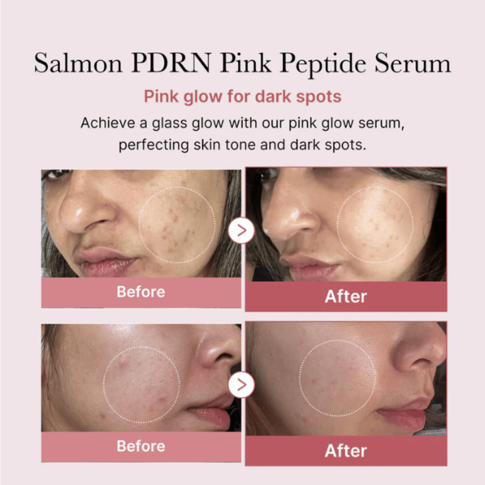 Medicube PDRN Pink Peptide Glow Serum 30ml- Lillys Pharmacy and Health Store