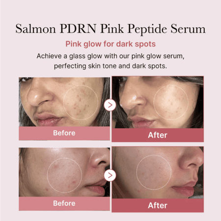 Medicube PDRN Pink Peptide Glow Serum 30ml- Lillys Pharmacy and Health Store