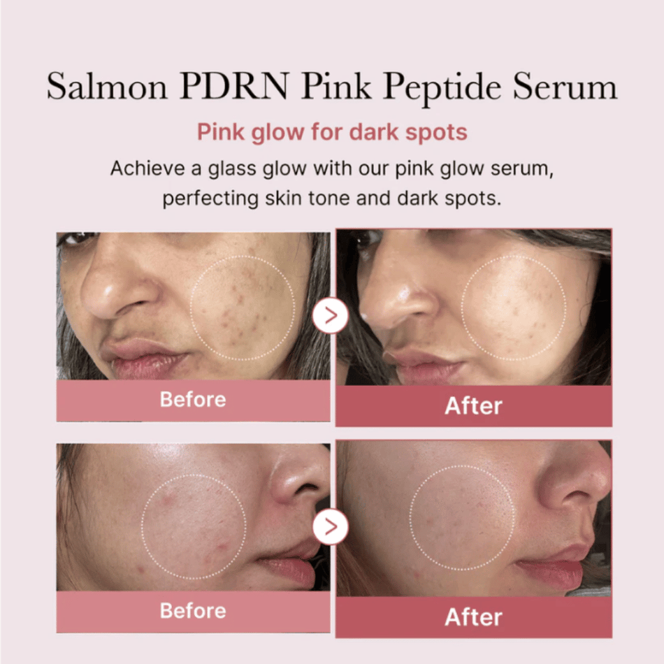 Medicube PDRN Pink Peptide Glow Serum 30ml- Lillys Pharmacy and Health Store