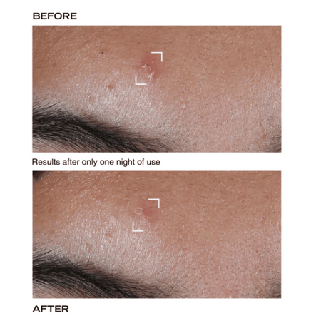PAYOT Pate Grise Stop Pimple Original Paste 15ml- Lillys Pharmacy and Health Store