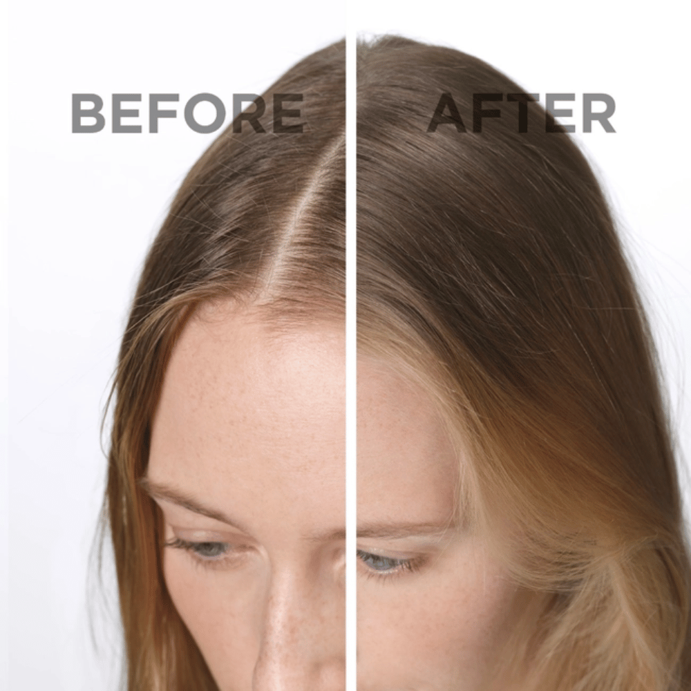 Phyto SOFTNESS Dry Shampoo 75ml- Lillys Pharmacy and Health Store