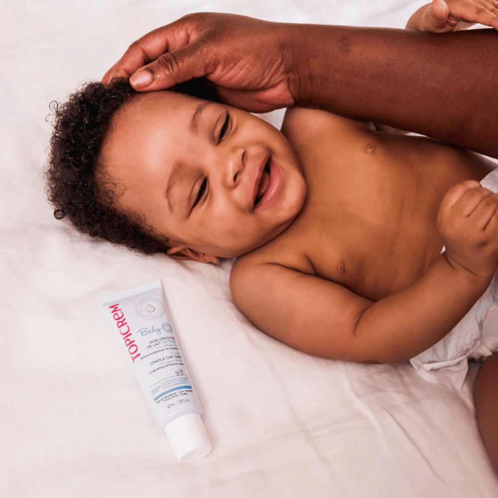Topicrem Baby Flash Cradle Cap Care 40ml- Lillys Pharmacy and Health Store
