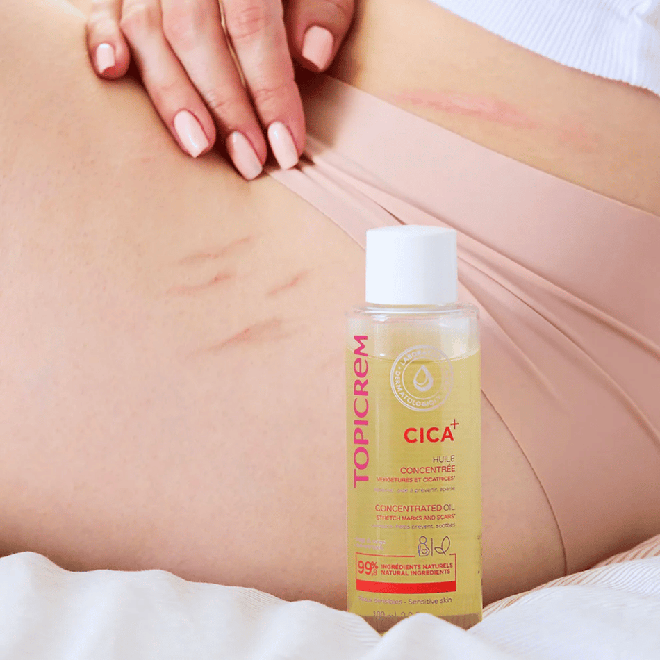 Topicrem Cica + Concentrated Oil For Stretch Marks And Scars 100ml- Lillys Pharmacy and Health Store