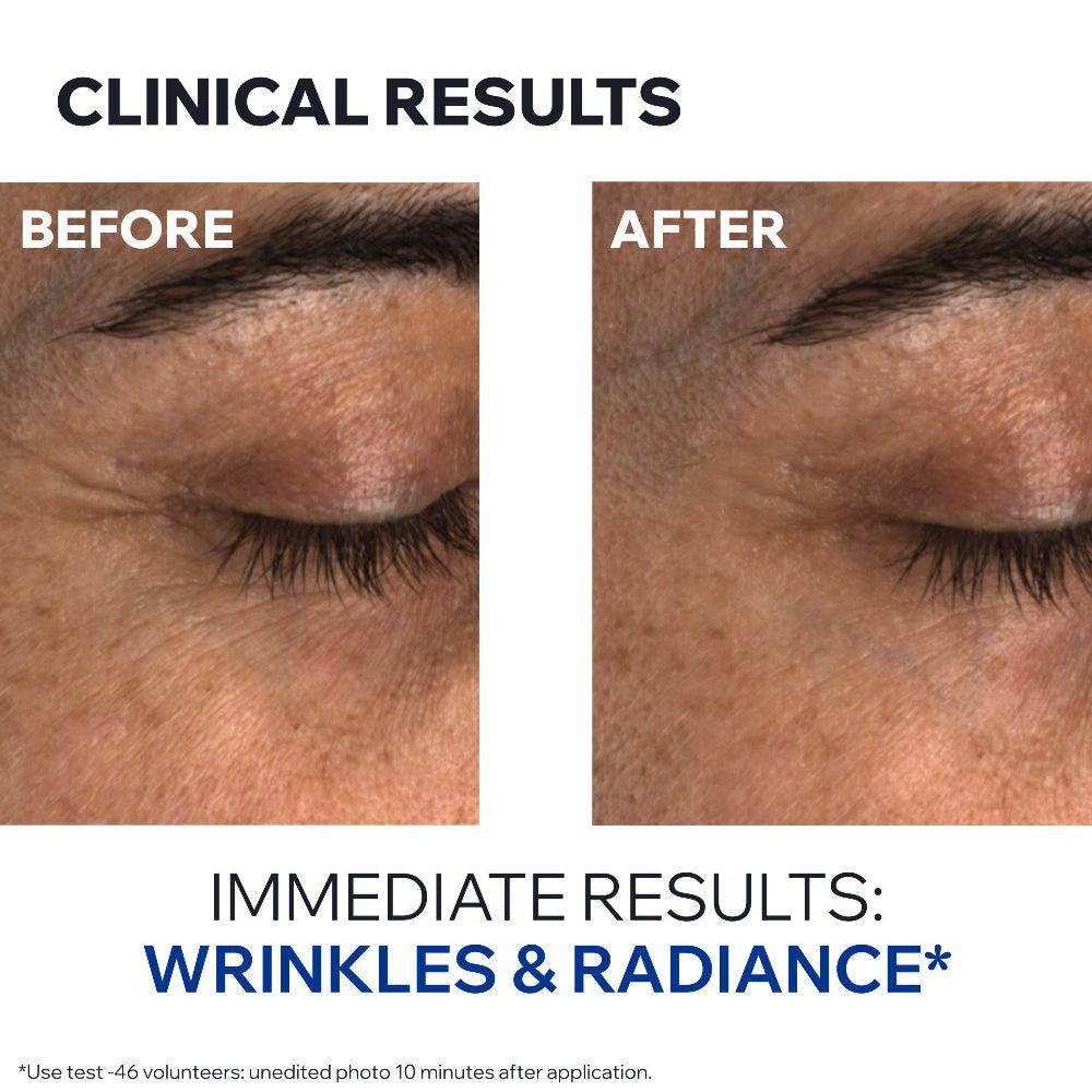 Uriage Age Absolu Eye Contour 15ml- Lillys Pharmacy and Health Store