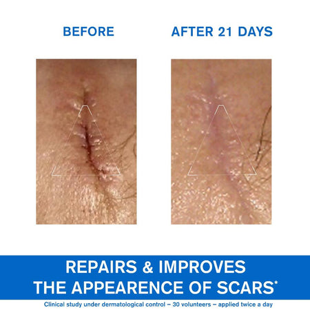 Uriage Bariederm Repairing Cica-Cream 100ml- Lillys Pharmacy and Health Store