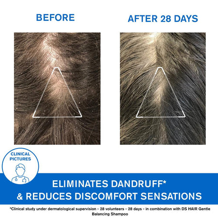 Uriage D.S. Hair Soft Balancing Shampoo Duo 2x500ml- Lillys Pharmacy and Health Store